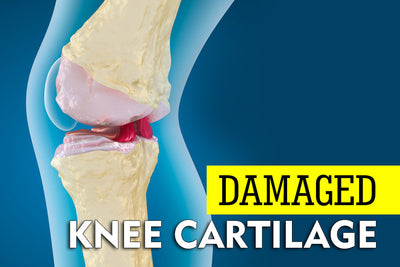 The Best Exercises for Damaged Knee Cartilage