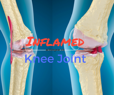 Dietary Tips for Inflamed Joints: Foods and Spices for Aching Knees
